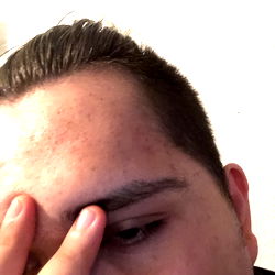 Person with Hand on Face