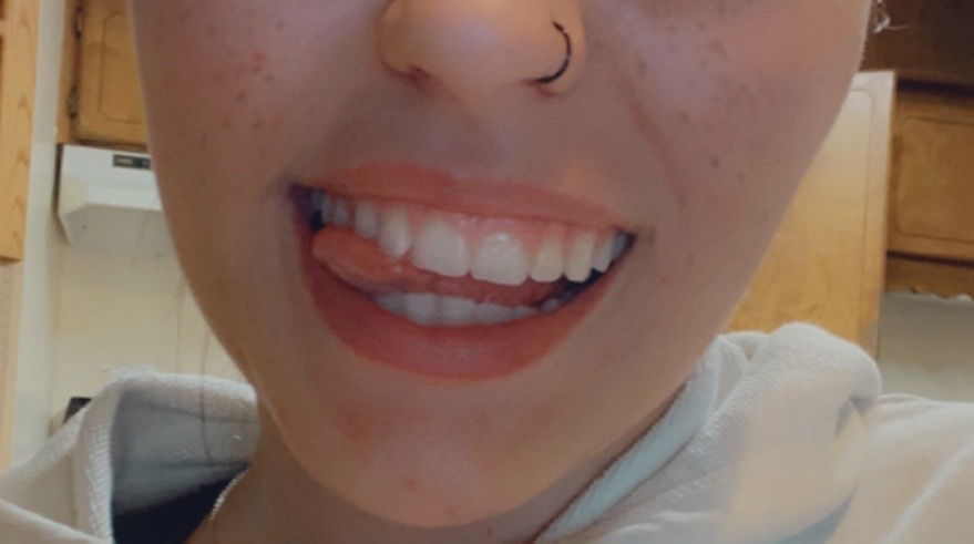 The Snack that Smiles Back photo