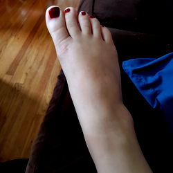 we have the feets photo