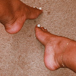 Anklets &amp; Arches photo