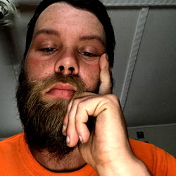 Andrew11090 - Bearded Man with Hand on Head