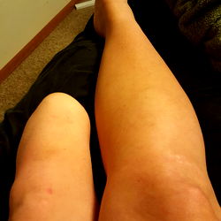 AmputeeAsh - OnlyFans Model Photos