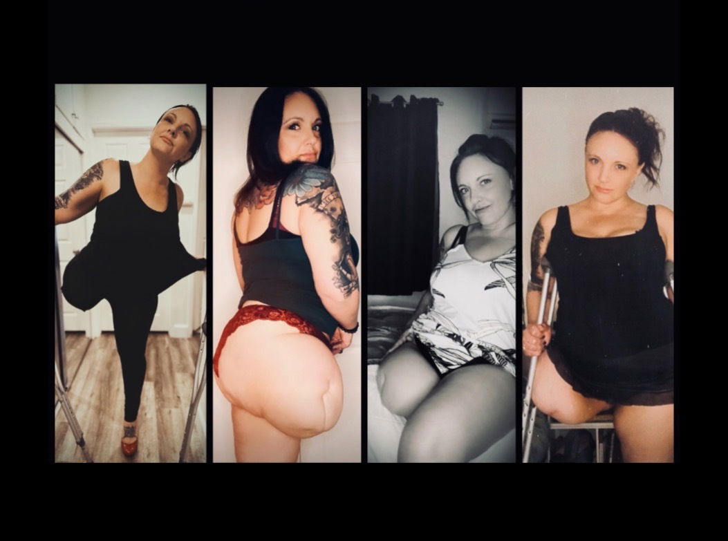 AAmputee Darling photo