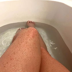 Rosie, a Model in Australia, Shares Her Bikini Moment