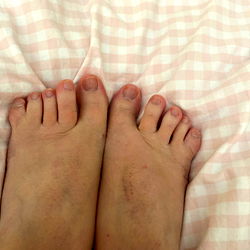 WebbedFeetRita's Toes on Display