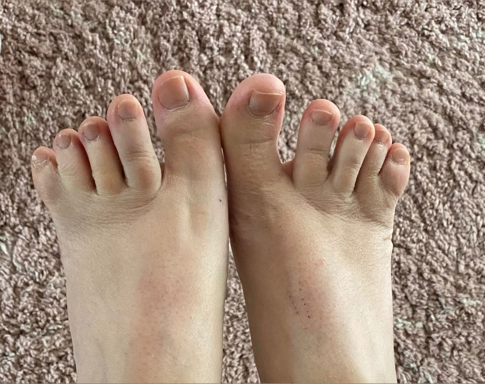 WebbedFeetRita photo