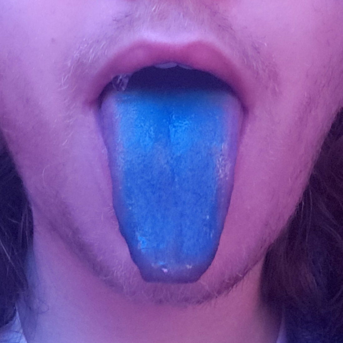Blue Tongued Skank photo