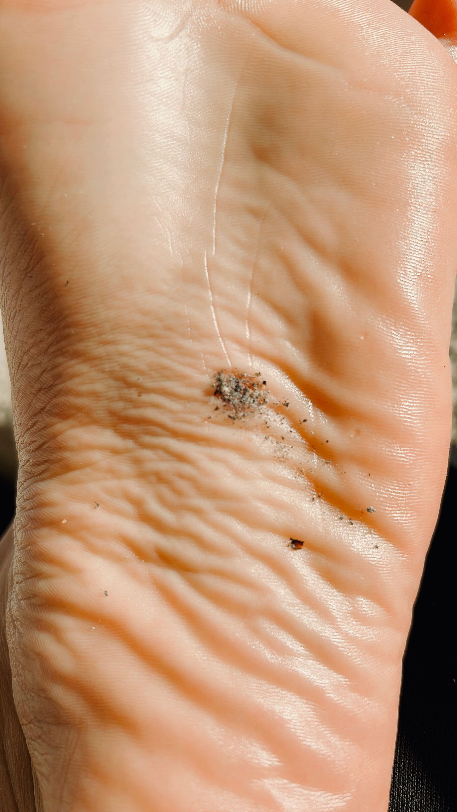 Aless white Feet photo