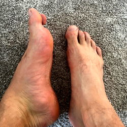 YouFootballmalefeets photo