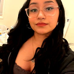 Alenny, the Saint Louis Model