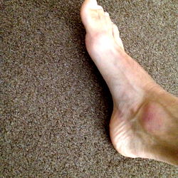 Size 11's Foot on Carpet